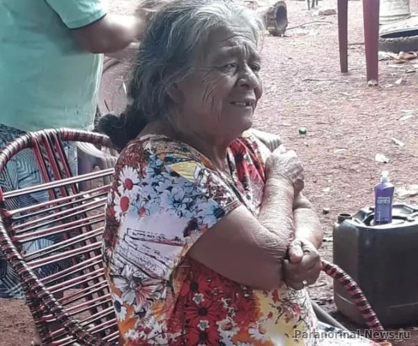 Женщина, которая более 50 лет носила в себе окаменелого младенца, скончалась после операции по его удалению | Болезни | Паранормальные новости | 21 Марта 2024
 
 