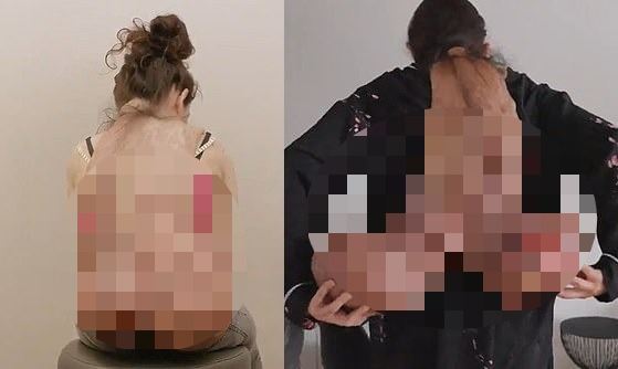 На шее женщины выросла опухоль весом в 9 кг | Болезни | Паранормальные новости | 11 Апреля 2024
 
 